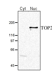 TOP2 | DNA topoisomerase II in the group Antibodies Plant/Algal / DNA/RNA/Cell Cycle / Transcription regulation at Agrisera AB (Antibodies for research) (AS05 096)